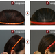 Image for article titled "Round Head" Plastic Surgery Seems Excessive, Even for South Korea